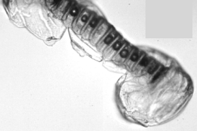 INPHYNI_Prop_Microfluidique_physico_chimie_et_biologie_aux_interfaces