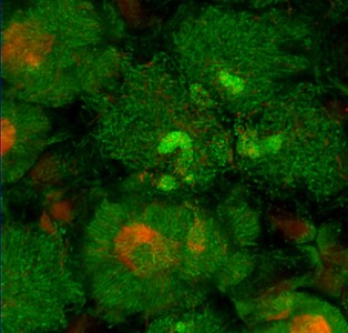 100 - Symbiosis or the art of compromise: from bacteria infection to domestication