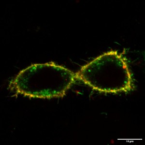106 - Cellules à l'infini