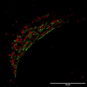 107 - Appareil de Golgi en superrésolution STED