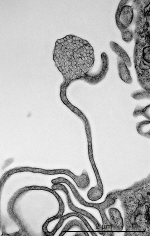 116 - Bouton floral de vésicules intracellulaires.