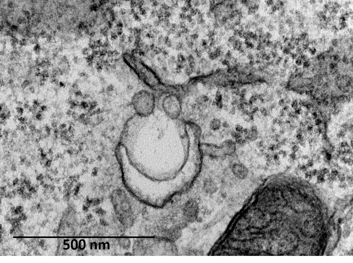 117 - Organite intracellulaire lapinesque et sympathique.