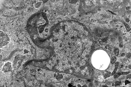 119 - Elephantus nucleus