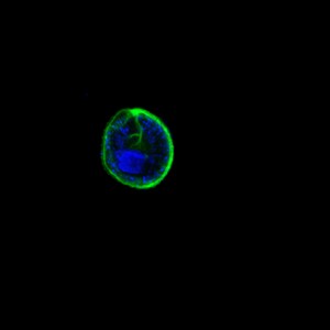 19 - Repositioning of the nucleus by microtubules in dinomitosis