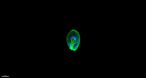 20 - Nuclear reposition by microtubules in Ostreopsis ovata