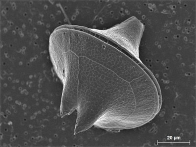 31 - Protoperidinium sp.