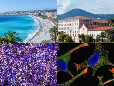 Event - Melanoma Workshop