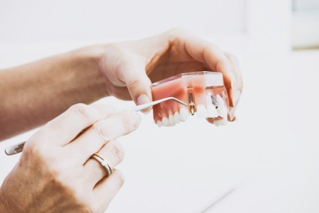 DU Prothèses sur Implants