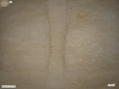Traces de scie sur un os